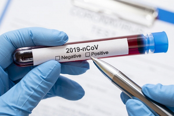 В Сочи зафиксировано ещё три новых случая заражения коронавирусной инфекцией